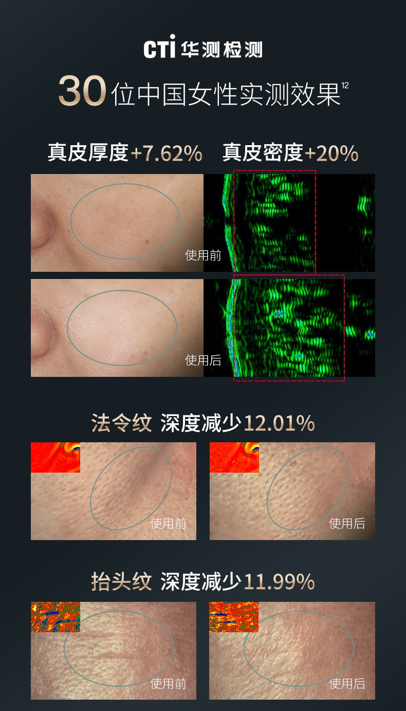 【返校季促销】中国直邮AMIRO觅光S1胶原炮美容仪器家用热玛吉脸部提拉紧致嫩肤射频仪