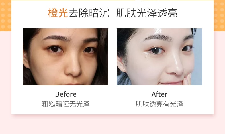 【中國直郵】卡蕾蘭 光子嫩膚儀臉部美容儀面膜面罩家用臉部光譜面罩排燈紅藍光 64 LED