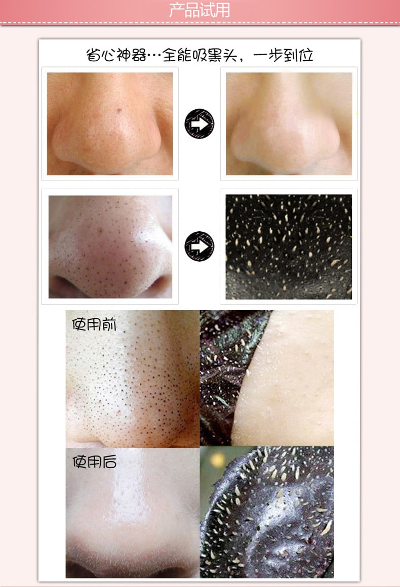 日本KOSE 高丝 SOFTYMO炭强力去黑头粉刺鼻贴10片