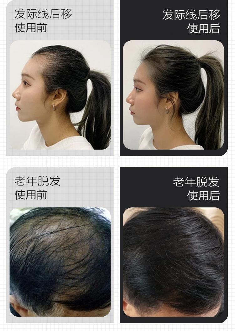 【中国直邮】 修正 防脱育发洗发液生姜侧柏叶生增发密发固发苗坚洗发水控油蓬松 防脱育发洗发水300ml