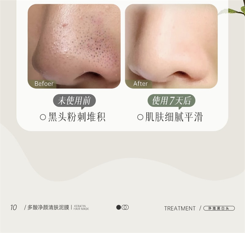 【中国直邮】 儒意 多酸净颜清肤泥膜 去黑白头闭口粉刺收缩深层清洁毛孔涂抹式积雪草清洁面膜 150g/瓶
