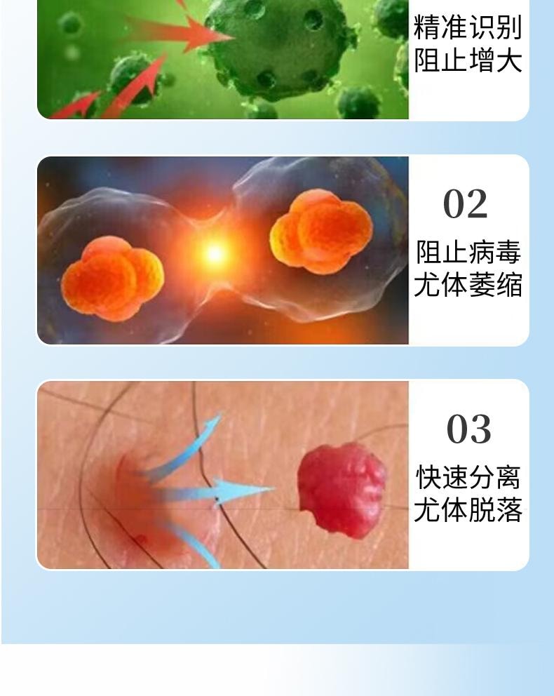 【中國直效郵件】 祥醫堂 鬼臼毒素酊 男女私處尖銳濕尤外用抑菌液 輕鬆應付各種尤痕包疹問題 10ml/盒