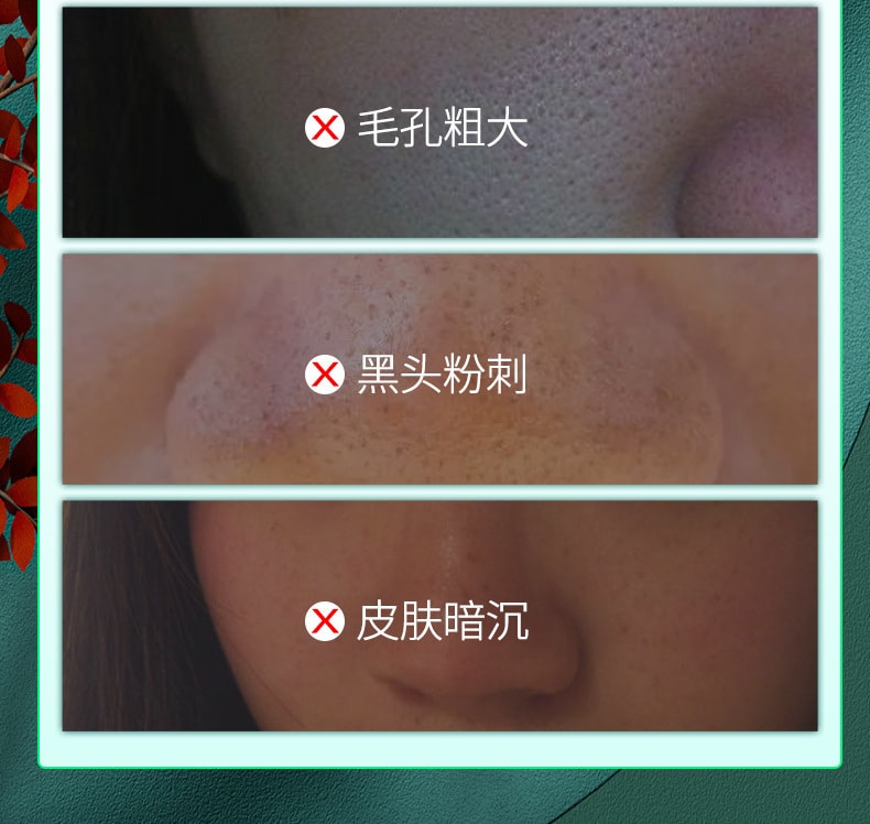 【中國直郵】水楊酸 清爽淨膚潔面乳 120g