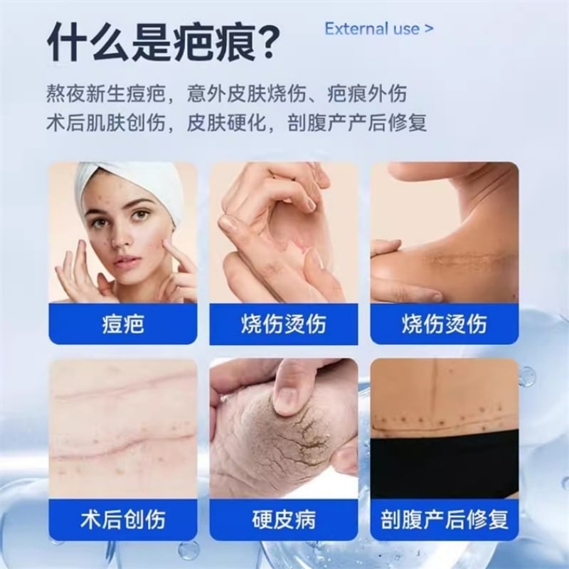 【中國直郵】 芙原 積雪苷霜軟膏 傷口癒合外傷 手術創傷 燒傷 疤痕疙瘩 硬皮病 20g/支