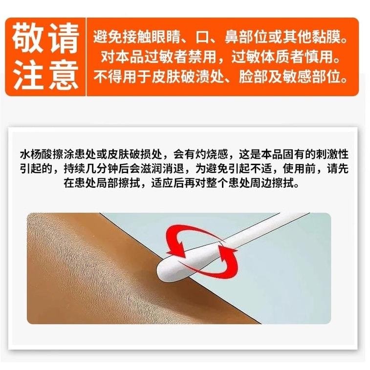 Compound salicylic acid solution is used for exfoliating dead skin on hands and feet with fungi 100ml per box