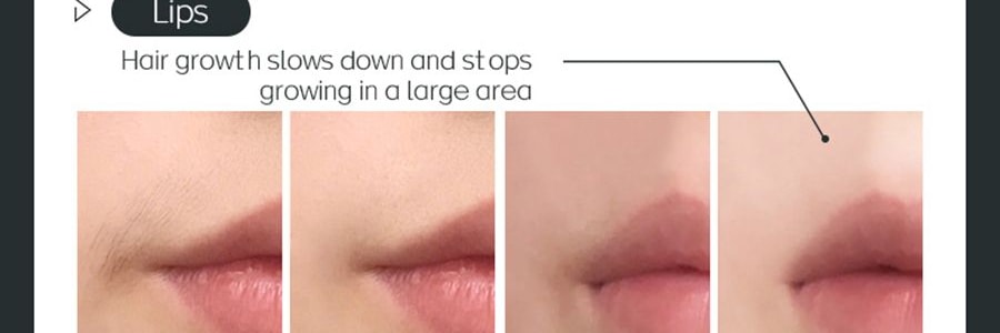 K·SKIN金米 IPL冰點除毛儀 99萬發閃光燈 全身除毛 #墨綠色 KD506A【張柏芝代言】