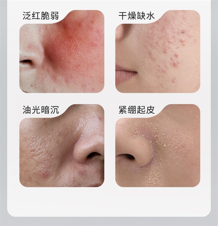 【中国直邮】 韩国 CJ希杰 CJ 熊果苷面膜 补水减黄焕亮肤色紧致贴片 乳酸杆菌面膜 25mlx5片/盒