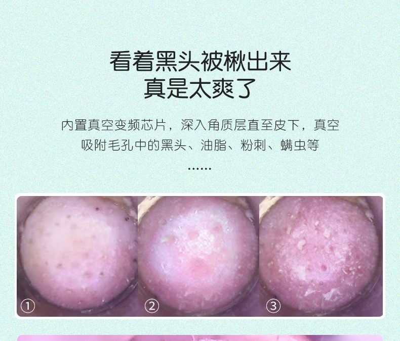 金稻电器 多功能美容仪 深层清洁 毛孔清洁 吸黑头仪 去粉刺小气泡 KD802P 绿色1台