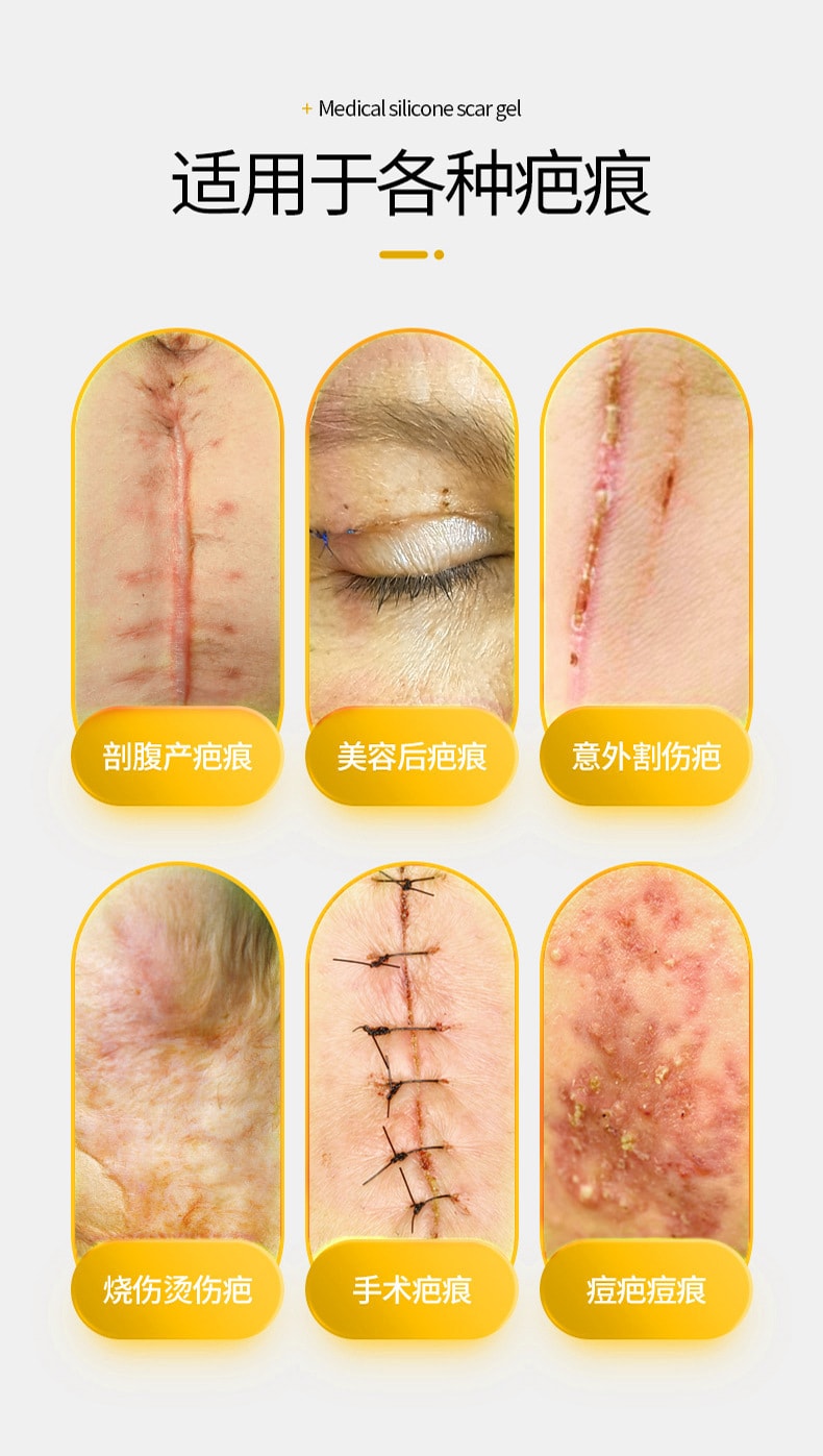 【中国直邮】葵花药业 医用硅酮疤痕凝胶 祛疤膏 烫伤 烧伤 术后创伤 疤痕修复凝胶 疤痕 20克/支