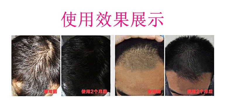日本 POLA宝丽 护发修复损伤发质增发防脱育发水 170ml