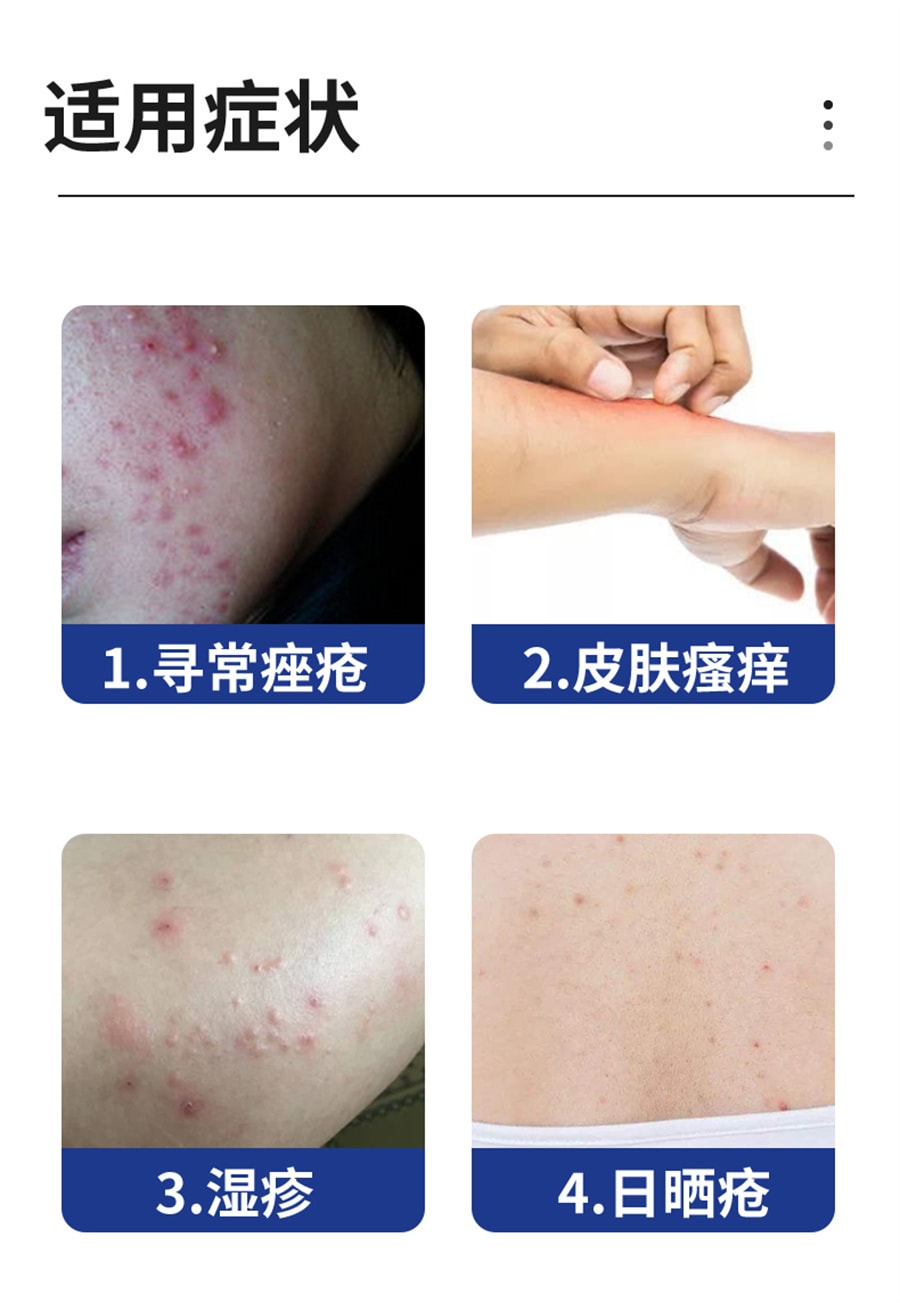 【中国直邮】良济 玫芦消痤膏祛痘痤疮痘疤湿疹青春痘皮肤瘙痒苗药 15g