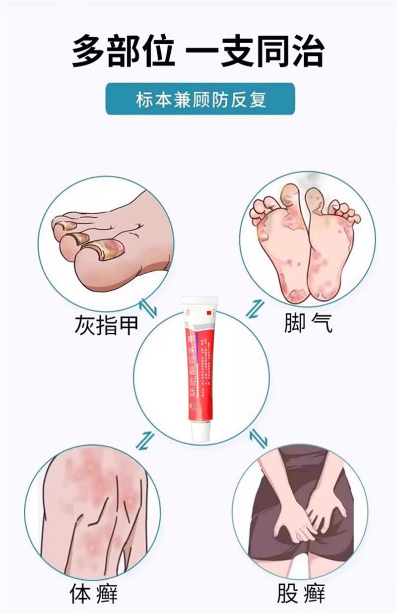  仁和 环吡酮胺乳膏10g灰指甲治疗专用药膏水正品真菌感染脚气药