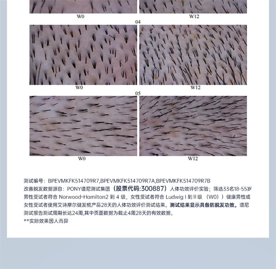 【中国直邮】艾诗摩尔  射频健发梳红光激防密脱头皮护理按摩增育养护电动发生仪  海渐蓝