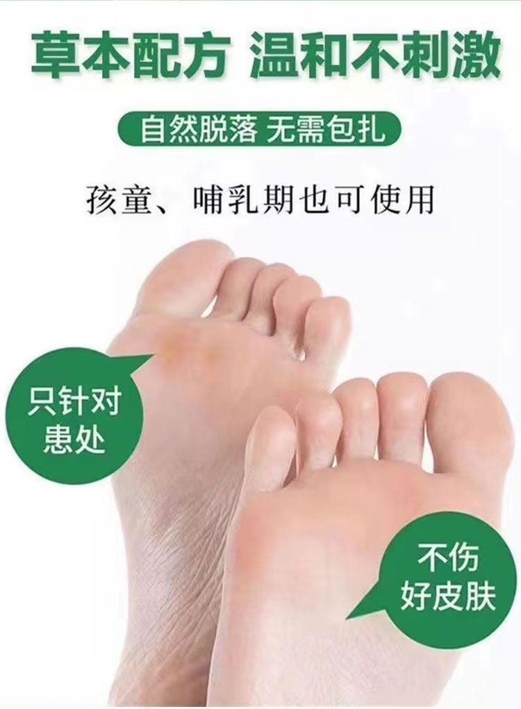 云南本草 鸡眼膏抑菌膏去鸡眼膏跖疣瘊子肉刺老茧除鸡眼贴 20g/盒(建议拍6支)