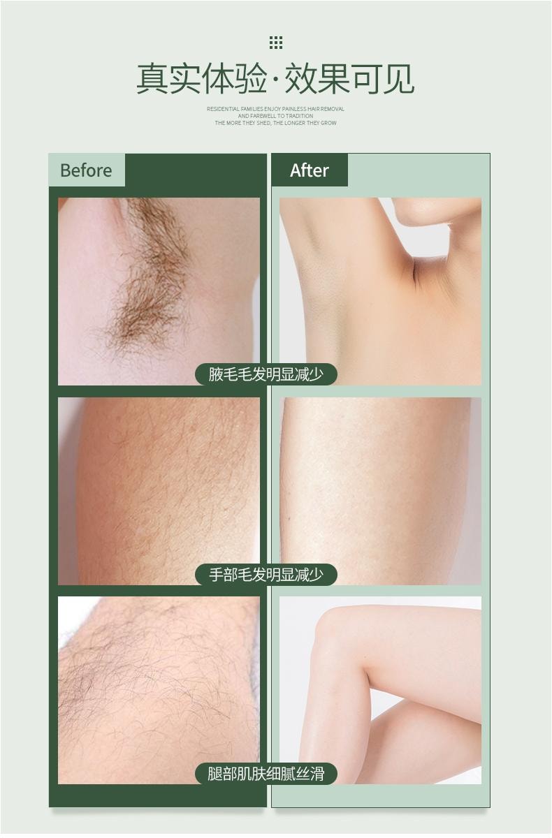 金稻 电动脱毛仪 私处毛修剪器 女士剃毛器 刮毛腋毛 全身可用 家用 KD50 绿色 1台