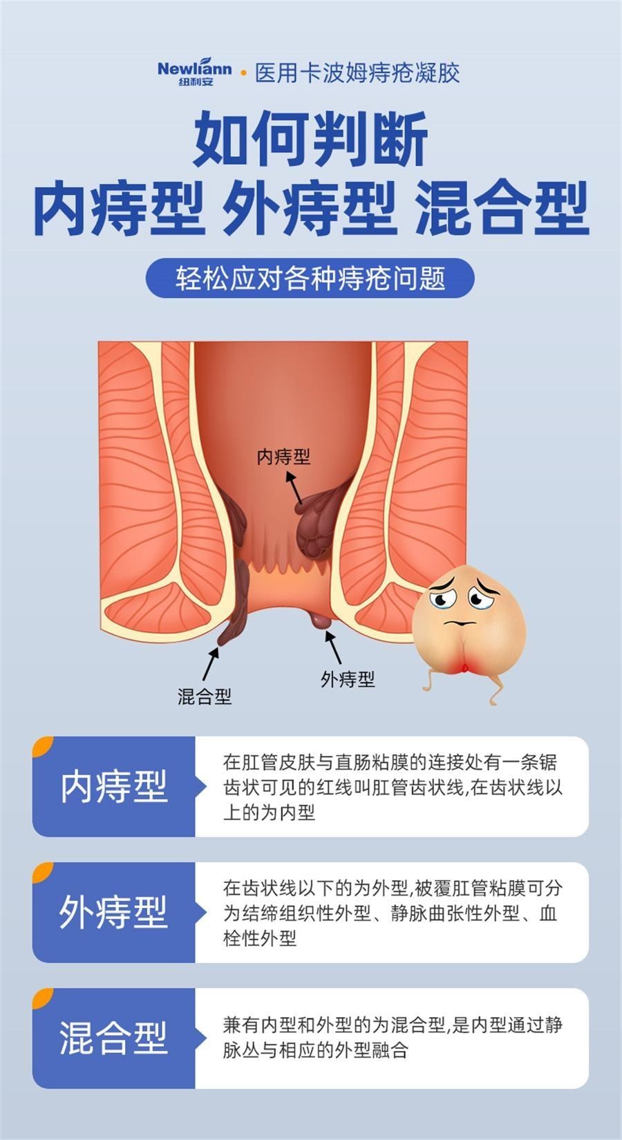 【中国直邮】 纽利安 医用痔疮凝胶 痔疮膏 消肉球肛门瘙痒卡波姆痣疮冷敷凝胶内外混合痔 5g/支*4支/盒