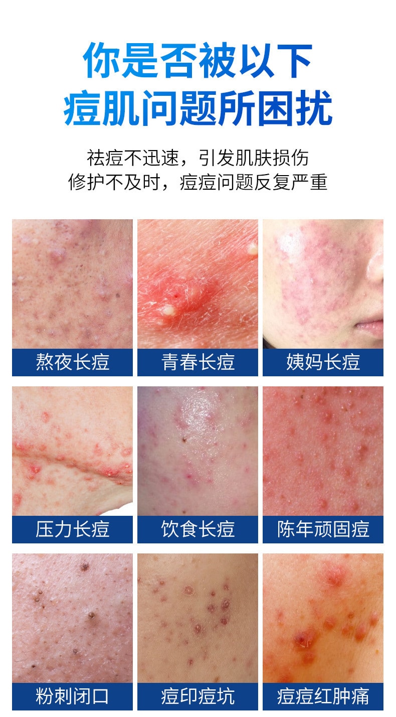 【中国直邮】仁和 水杨酸祛痘调理乳淡化痘肌痘印温和去痘痘30g (买二送一)