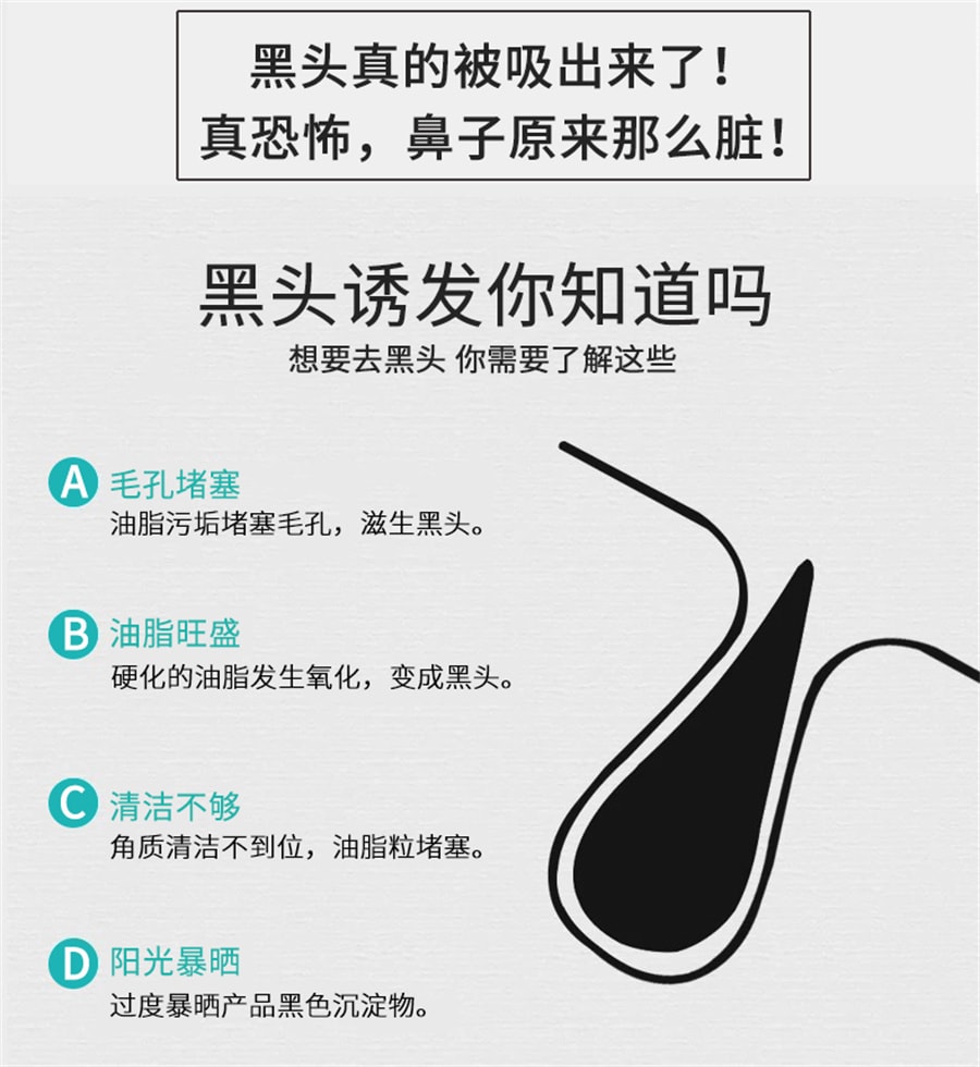【中国直邮】爱兰歌娜 去黑头收缩毛孔粉刺鼻贴泥膜深层清洁撕拉竹炭黑头面膜男士专用祛吸出神器 190ml