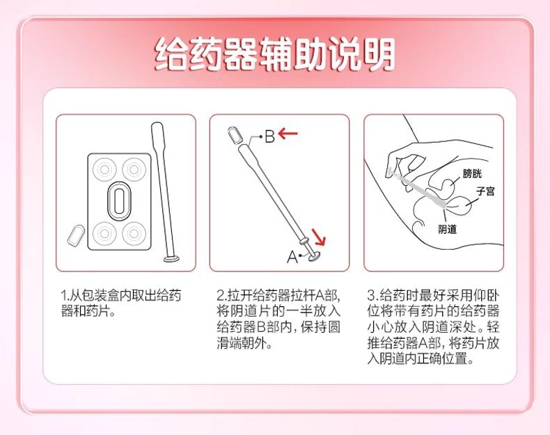 凯妮汀 克霉唑阴道片 1片 阴道炎 妇科炎症专用药 一盒一片一疗程 单盒装