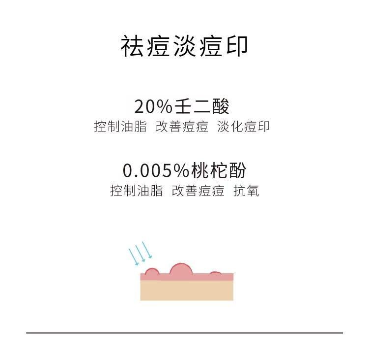 【中國直郵】 John Jeff 20%壬二酸霜15g 快速祛痘 卓效控油