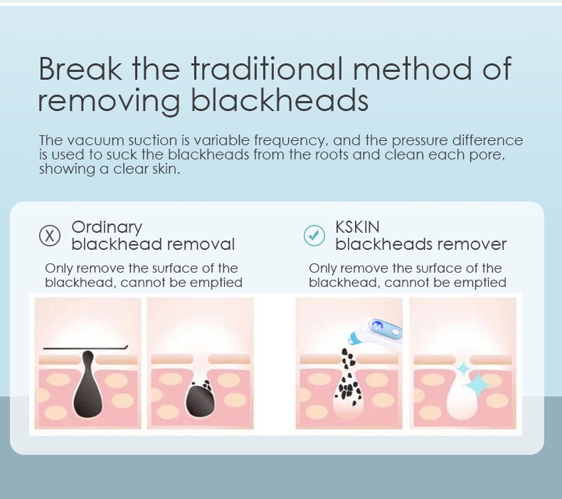 K·SKIN金米 電動吸黑頭儀 去粉刺小氣泡美容儀器 毛孔清潔導出儀KD802白色 1台