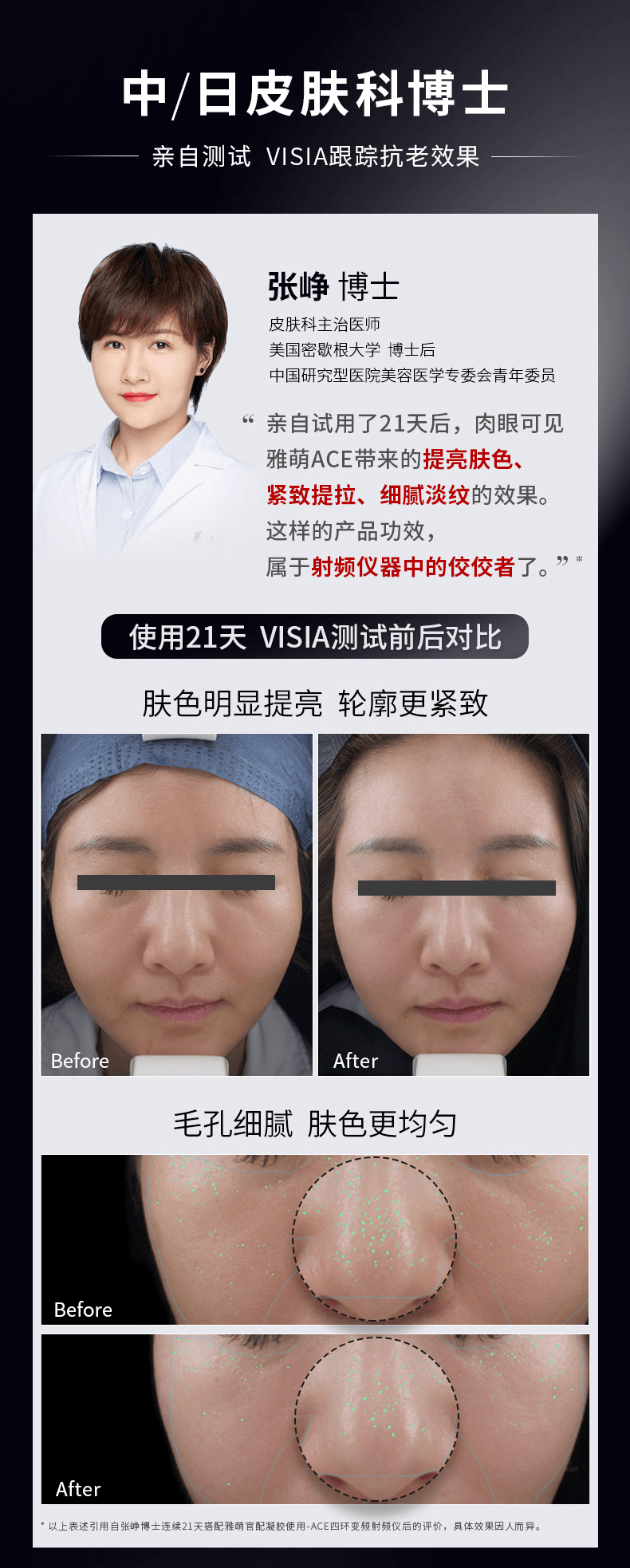 【日本直郵】日本 雅萌 YAMAN ACE 家用臉部紅光四環變頻射頻儀 提拉緊緻淡化皺紋美容儀 內贈80g凝膠