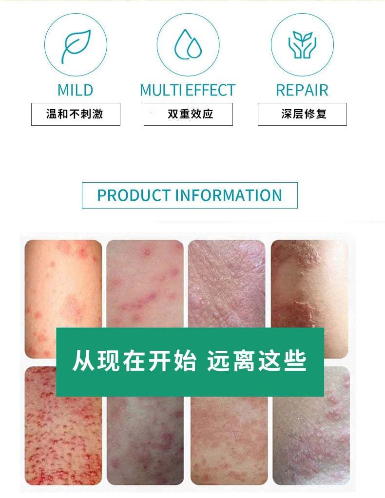 中國 嚴和 腳氣偏方軟膏20g/盒 皮膚外用深層修復 抑菌 止癢