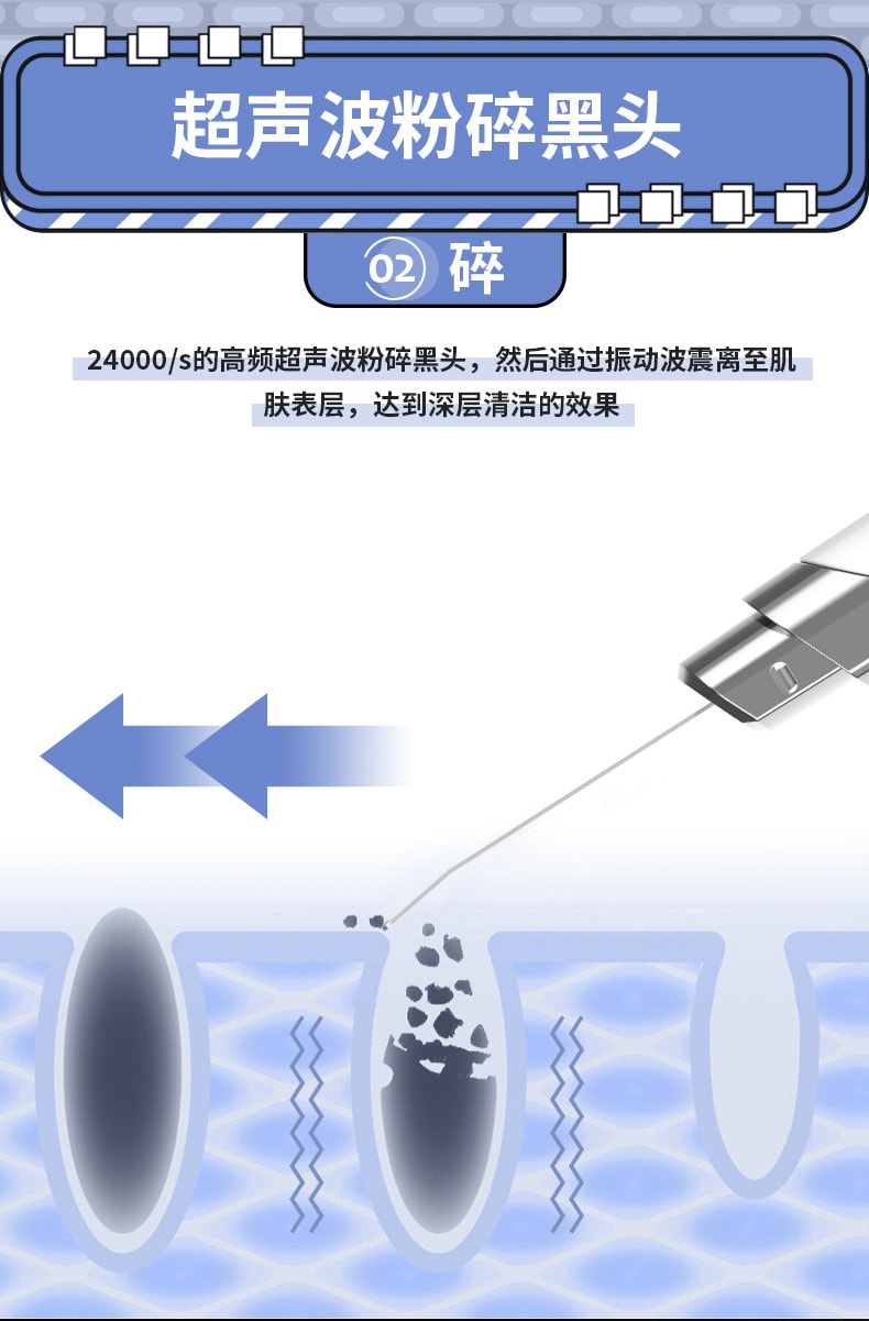 【中國直郵】鑫友 超音波鏟皮機毛孔清潔器潔面去黑頭鏟美容儀器 白色 3檔