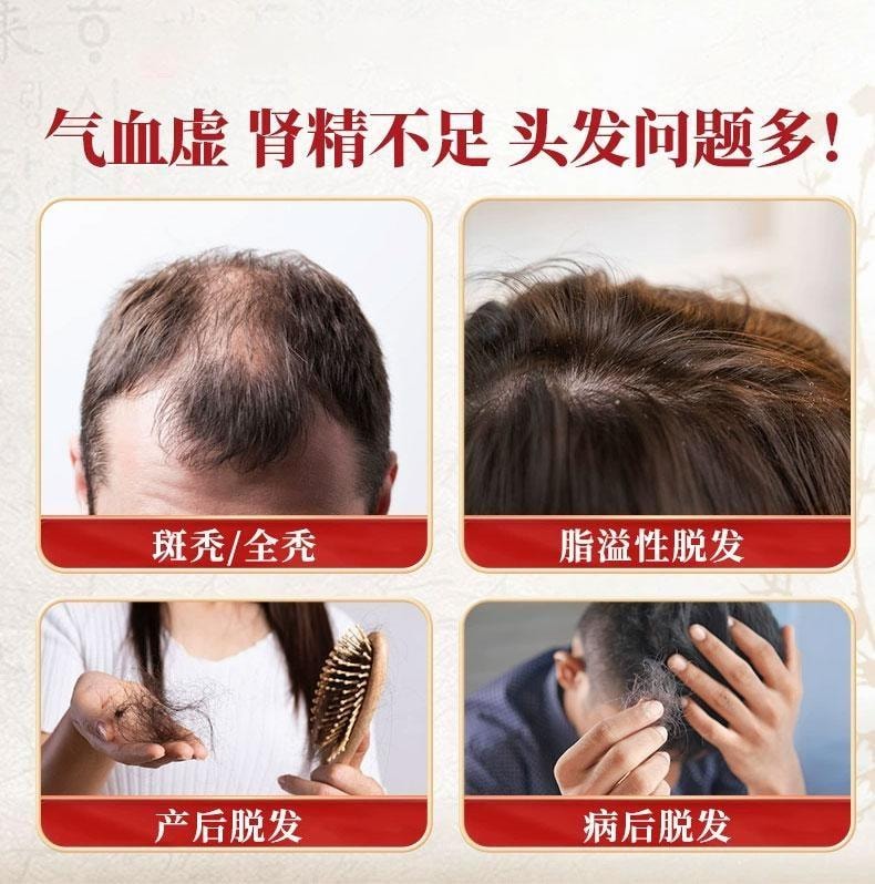 Yangxue Shengfa Capsules: 30 Capsules for Nourishing Blood Benefiting the Kidney and Filling Essence