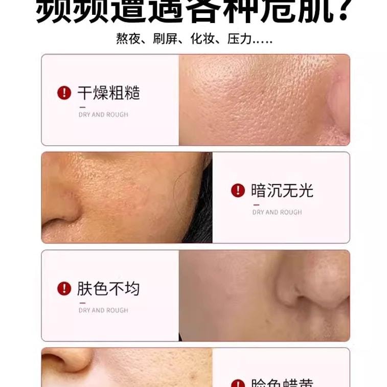 【中國直郵】 臻羞 複方熊果苷乳膏非醫用去黃乳霜改善暗沉菸鹼醯胺凝膠 30g