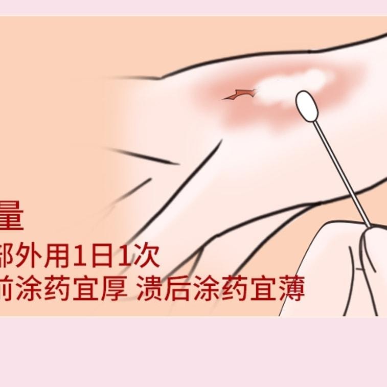 马应龙 龙珠软膏 消肿止痛 清热解毒 用于红肿冻疮疮疖红肿轻度烫伤 15g/盒(医师推荐拍3盒)