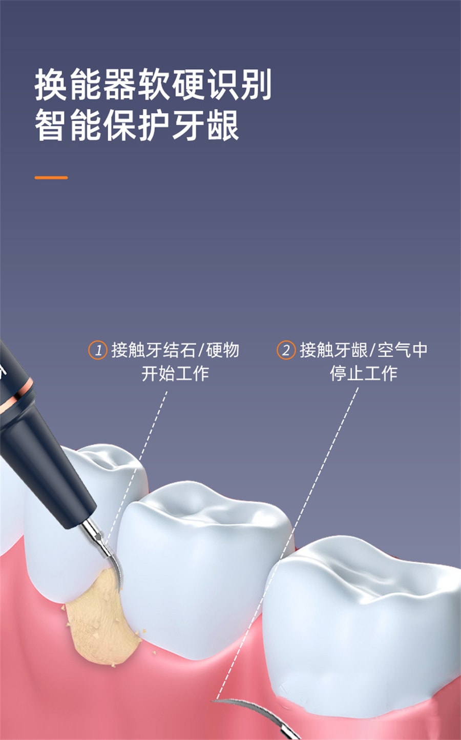 【中国直邮】康佳  超声频率波洁牙器去牙结石去除器洗牙器超声波除牙石洁牙仪  星空蓝