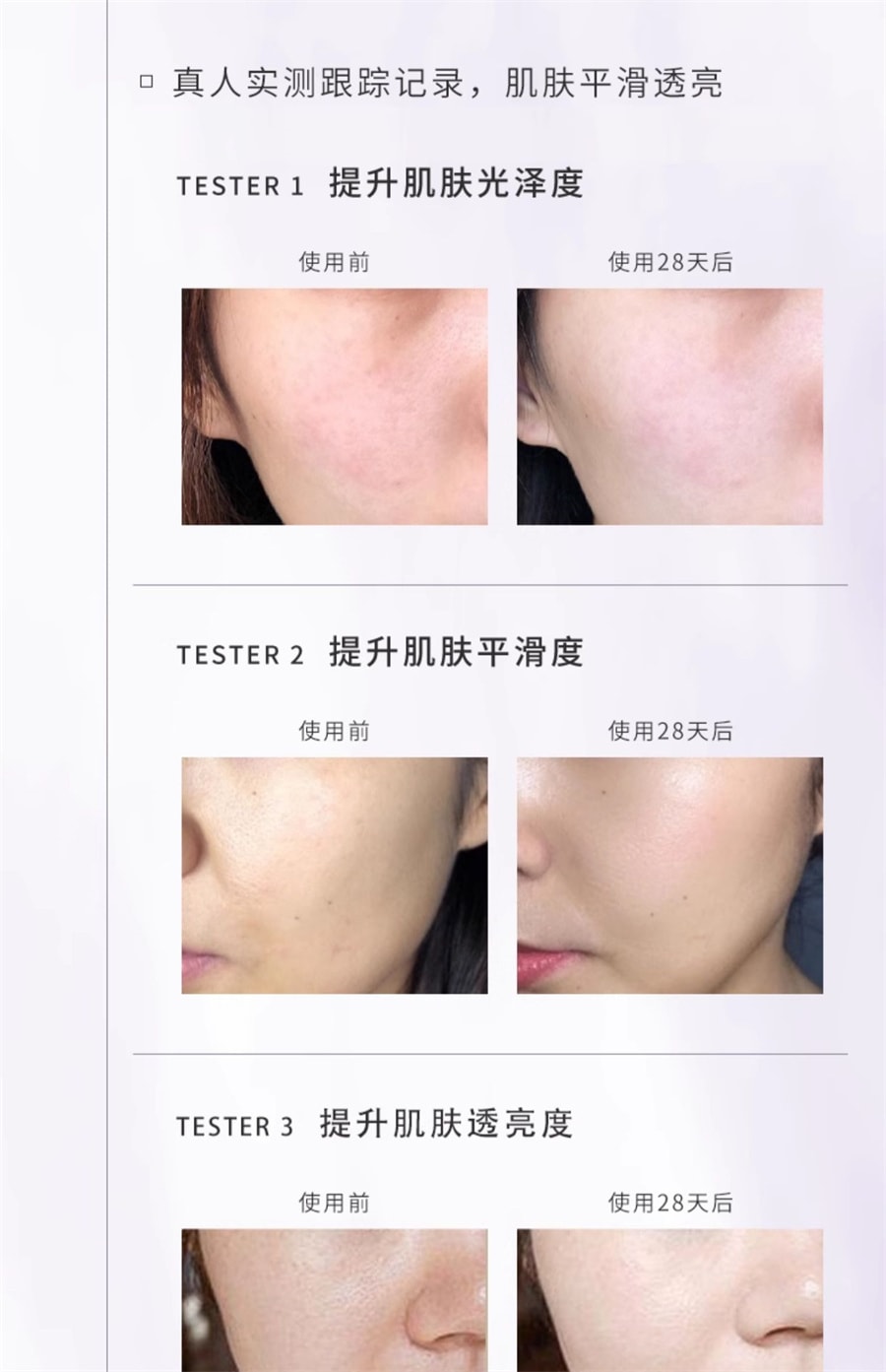 【中国直邮】枫缇 红石榴精华油熬夜提亮抗皱夜间保湿紧致以油养肤次抛面部胶囊 21粒