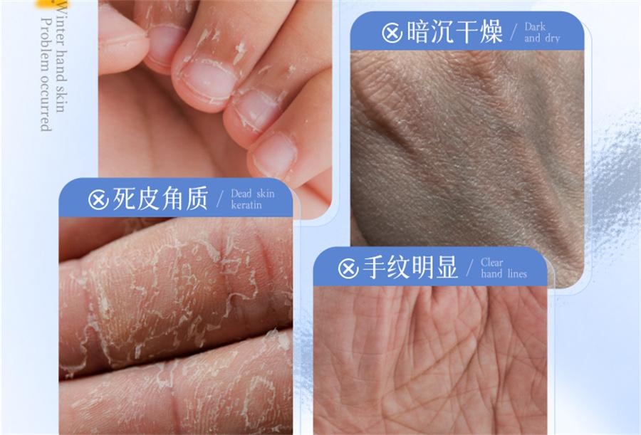 【中国直邮】 ORGINESE 377美白手膜嫩白保湿补水手部护理细嫩双手细纹手套去黑  10片/盒