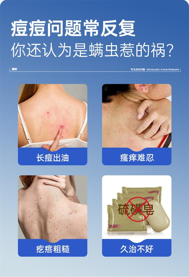 【中国直邮】 丽芙 克林霉素磷酸酯外用溶液 毛囊炎前胸后背祛痘喷雾背部祛痘除螨 30ml