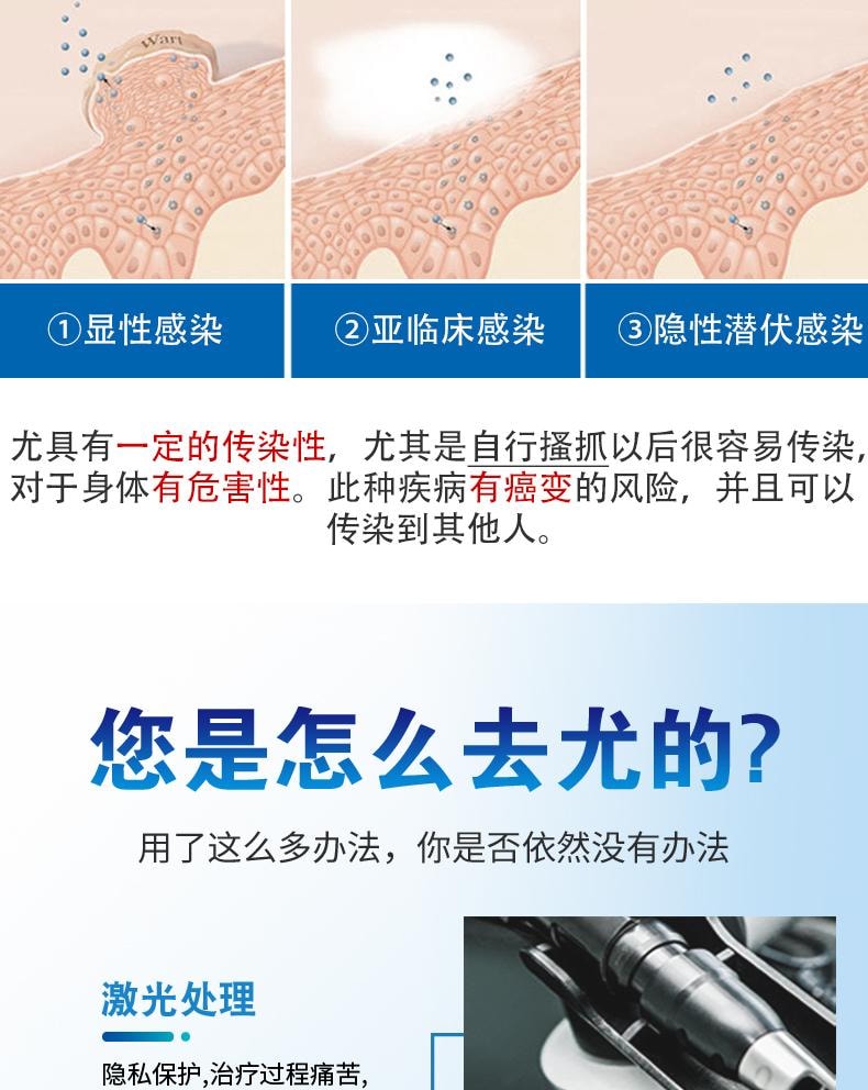 【中國直效郵件】 祥醫堂 鬼臼毒素酊 男女私處尖銳濕尤外用抑菌液 輕鬆應付各種尤痕包疹問題 10ml/盒