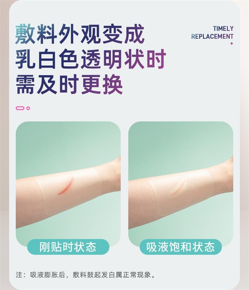 【中国直邮】 海氏海诺 医用水胶体敷料5片/盒 人工皮伤口愈合净痘人造皮肤贴大片痘痘贴