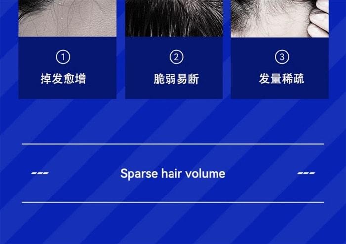 【中国直邮】 海洋至尊 强韧健发洗发水 男士生姜固育发去屑止痒300ml/瓶