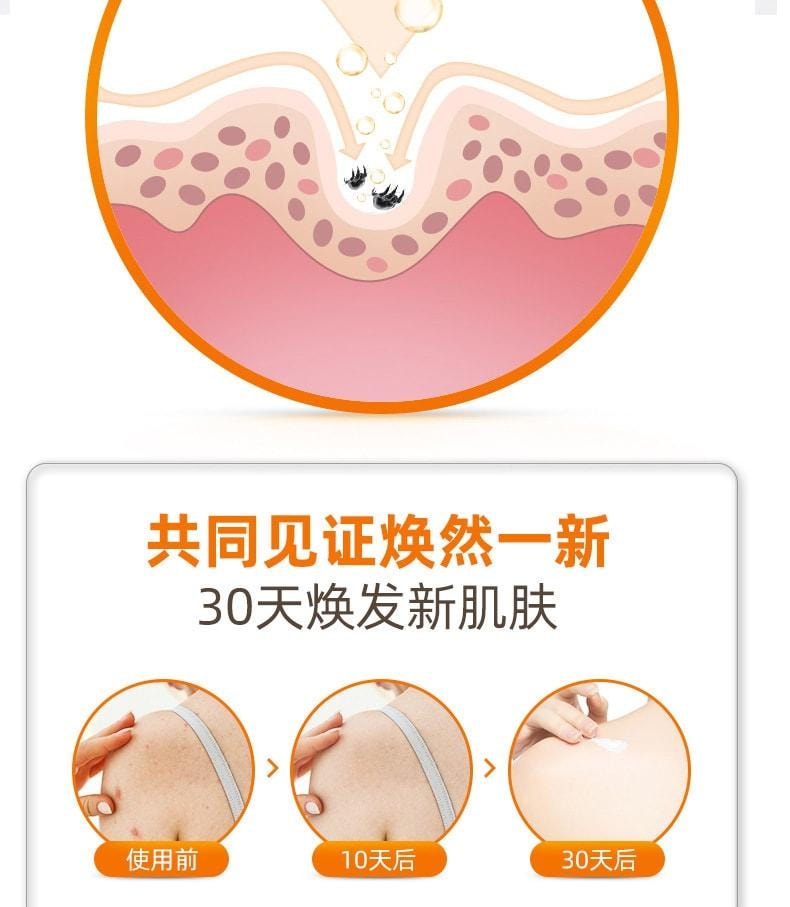 【中国直邮】 广药白云山 苦参慕斯沐浴露 香沐浴乳持久留香除螨痘肌沐浴液400ml/瓶
