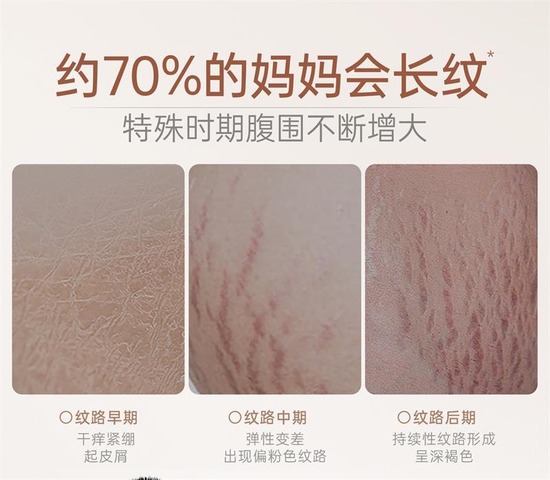 【中國直郵】 袋鼠媽媽 撫紋霜準孕婦專用妊娠霜撫紋乳橄欖油妊娠油淡化身體紋路 進階2件組 96ml+50g