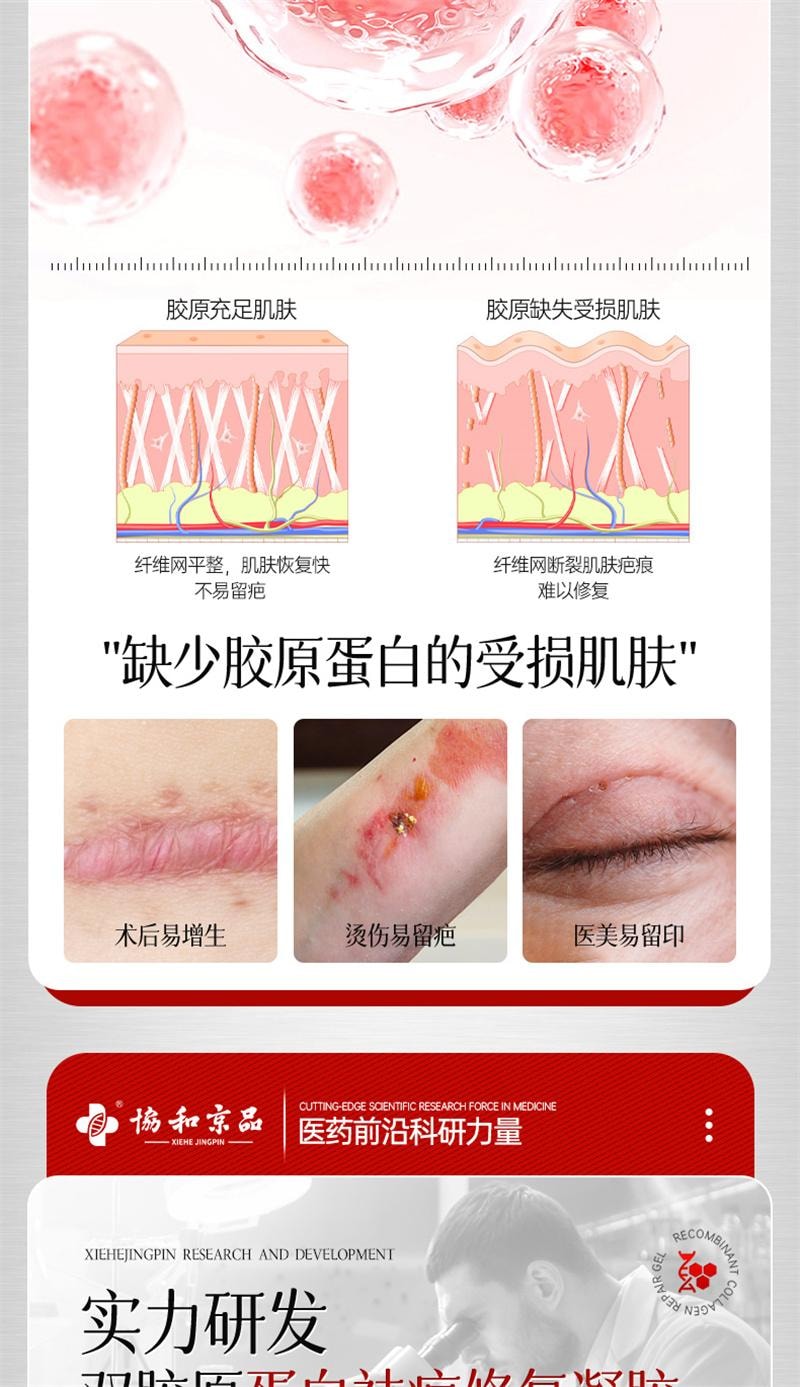 【中國直郵】 協和京品 祛疤膏疤痕修復除疤剖腹產手術疤兒童燙傷增生凸起去疤貼醫用重組膠原蛋白修復凝膠 20g