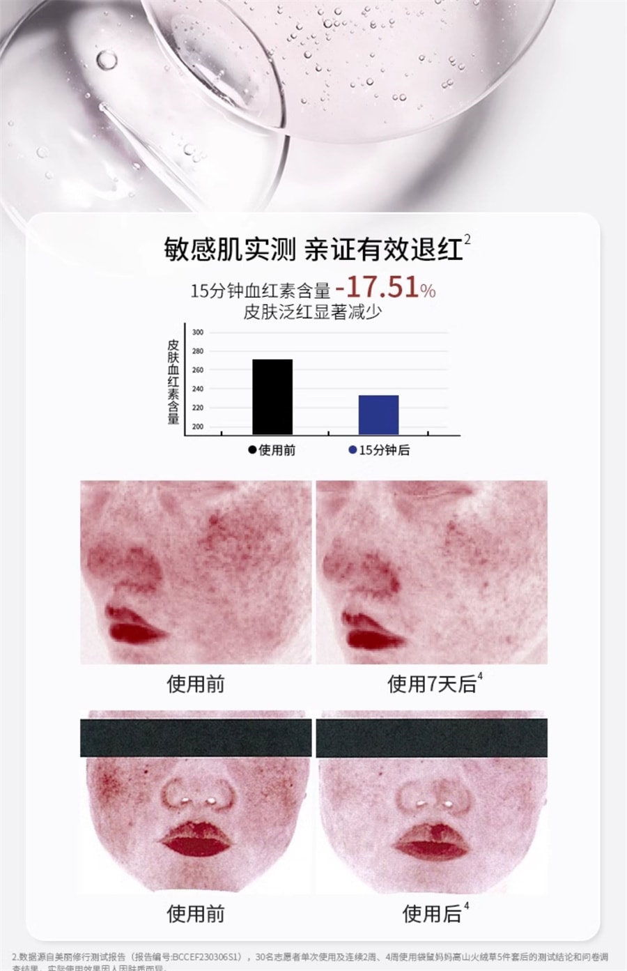 【中国直邮】袋鼠妈妈  修护水乳准孕妇护肤品高山火绒草套装补水保湿专用化妆品  洁面慕斯135ml+水100ml+乳100g