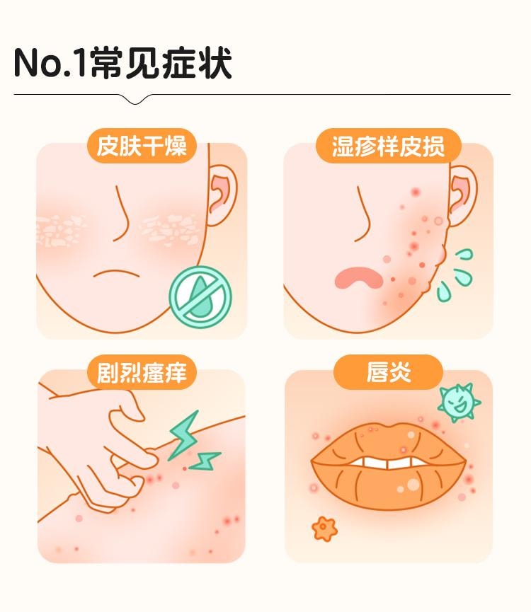 【中國直郵】 華邦 鹵米松乳膏 用於非感染性發炎性皮膚病 脂漏性皮膚炎、尋常型乾癬 10g*1支/盒
