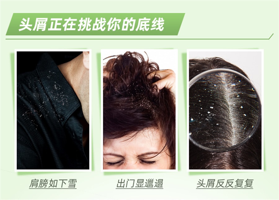 【中國直郵】999 二硫化硒洗劑脂漏性皮膚炎洗髮精止癢洗頭膏去頭皮屑藥 50g/盒