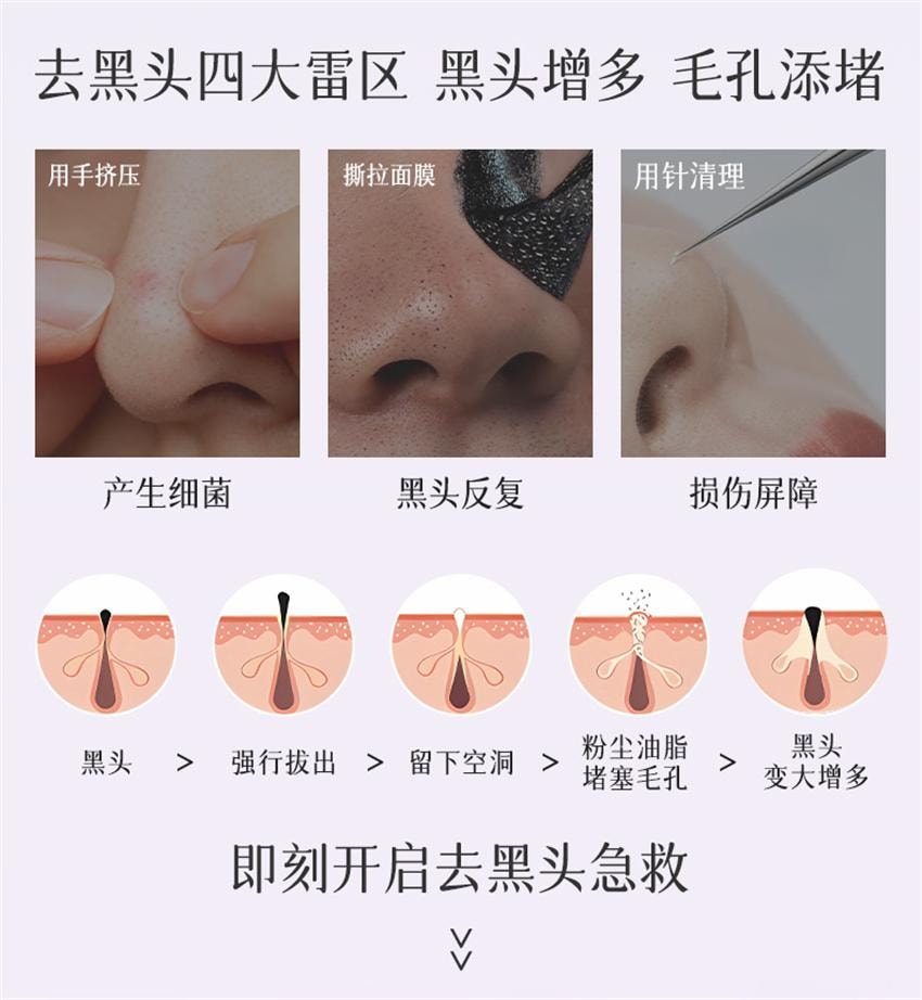 【中國直郵】ELI 紫蘇植酸清肌淨顏泥膜 去黑頭控油祛痘舒緩收毛孔溫和保濕敏肌 100g/支