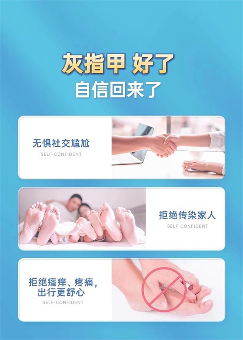  仁和 环吡酮胺乳膏10g灰指甲治疗专用药膏水正品真菌感染脚气药