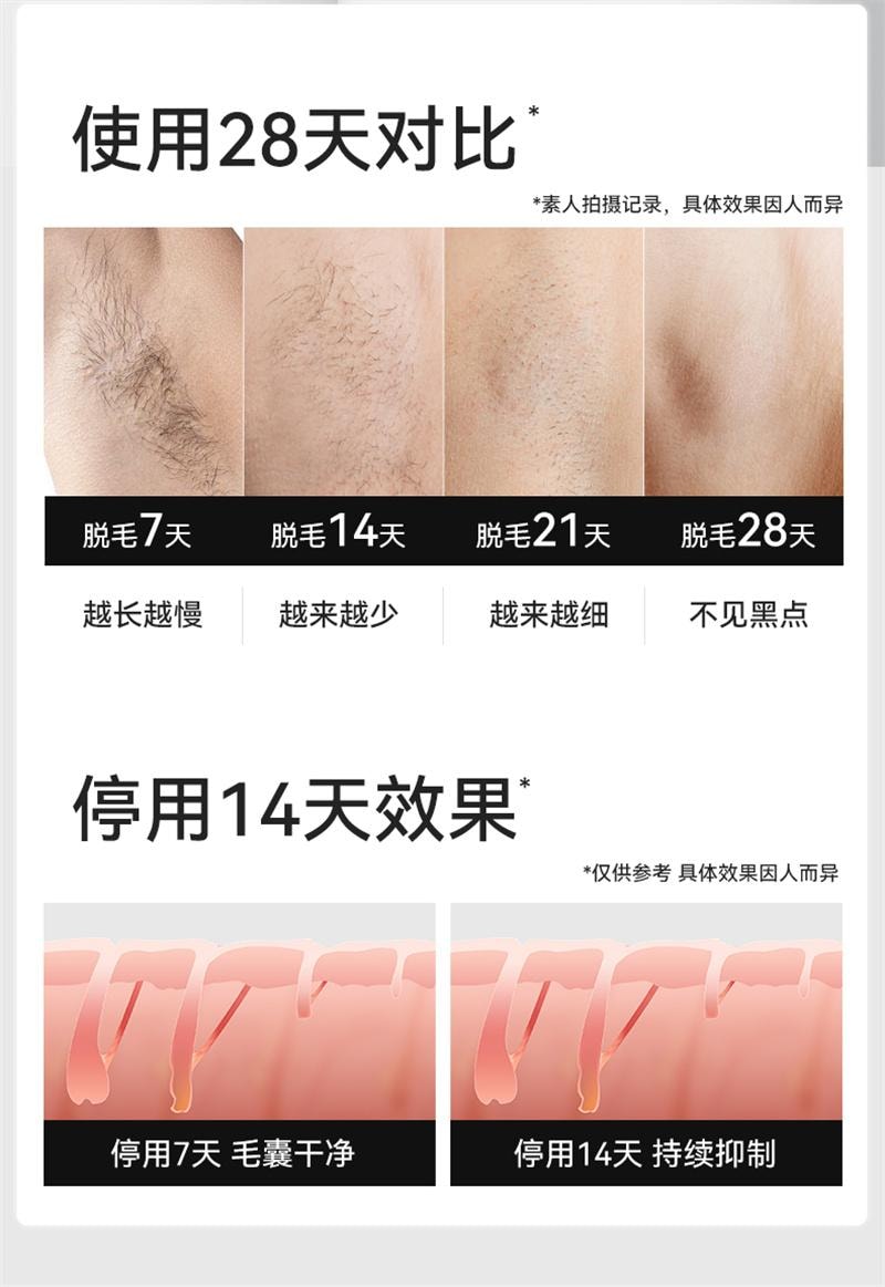 【中国直邮】 康佳 冰点蓝宝石脱毛仪唇毛腋下全身 冰点蓝宝石 香芋紫