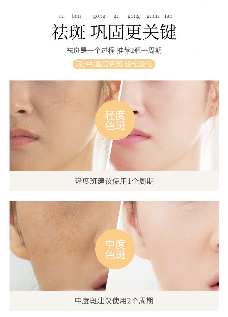 【中國直郵】國藥 日出傾城美白淡斑液 30ml
