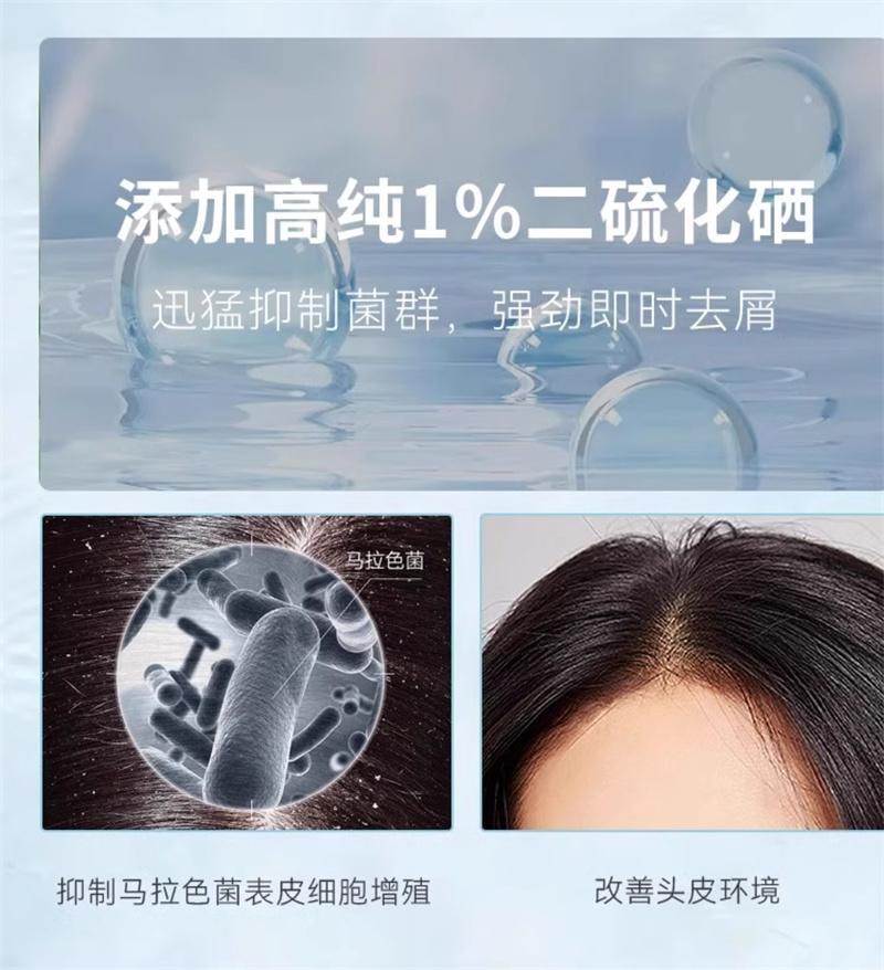【中国直邮】 999 二硫化硒洗剂去屑洗头水控油洗发液止痒洗发水露 200ml