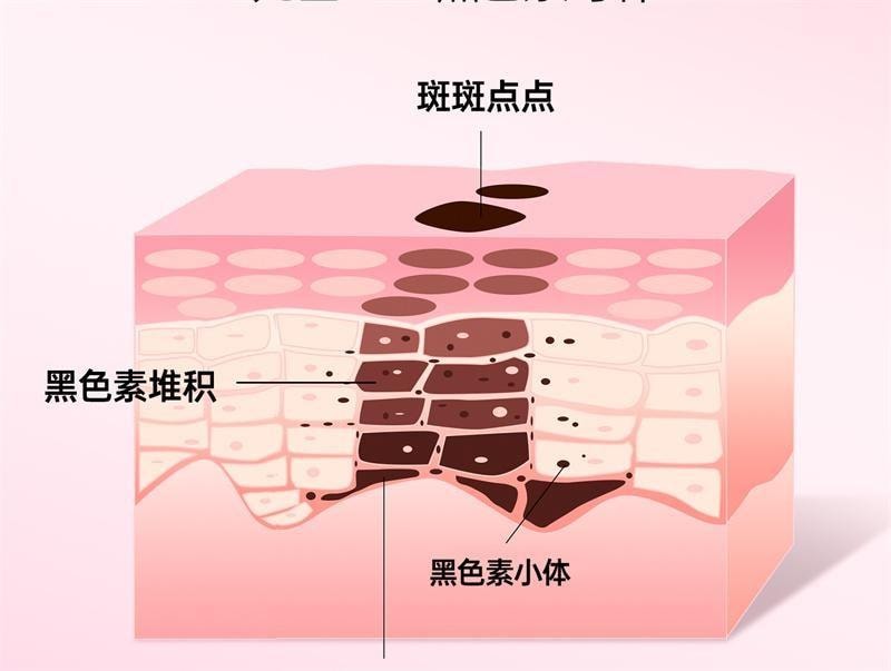 【中国直邮】 红桃K 美颜口服液 祛黄褐斑正品祛斑内服调理去斑内调黄褐斑养颜 10ml*7瓶/盒